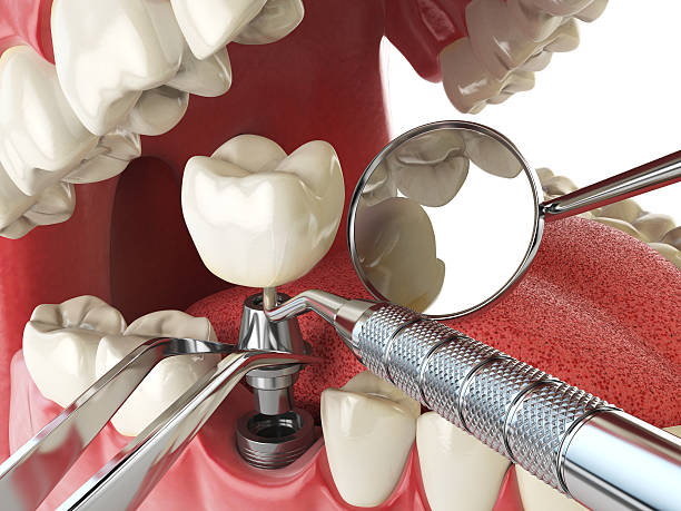 Best Emergency Root Canal Therapy in Walkersville, MD
